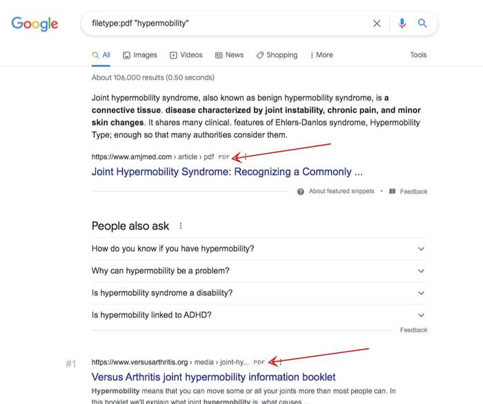 filetype pdf hypermobility google search